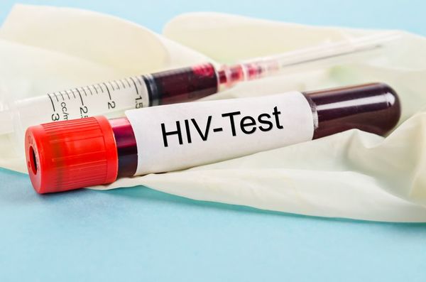 Cómo unos pocos individuos consiguen controlar el VIH sin tratamiento - Ciencia - ABC Color