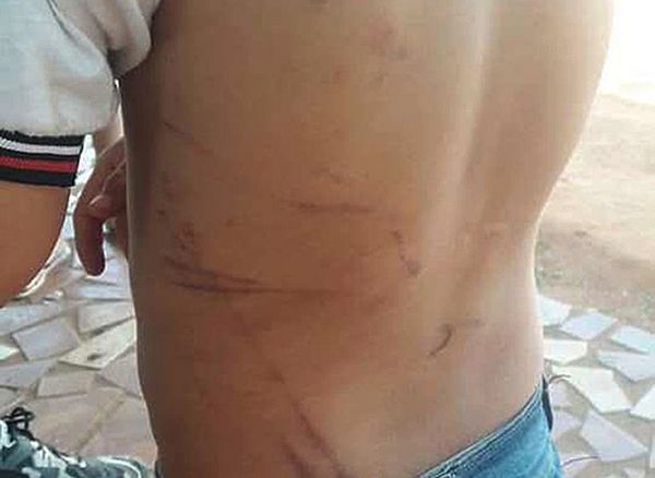 Imputarán a padrastro por severos castigos a niño - ABC en el Este - ABC Color