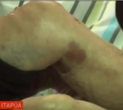Golpean y asaltan a abuela en su propia vivienda - Paraguay.com