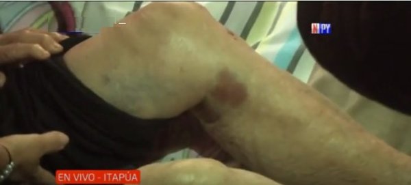 Septuagenaria fue violentamente asaltada en su propia vivienda | Noticias Paraguay