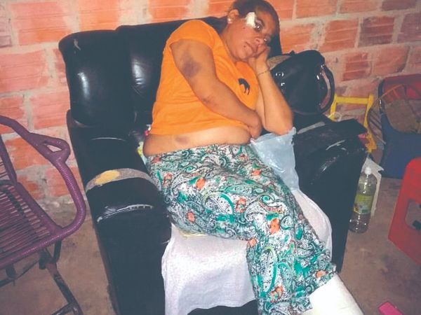 Acusó a padrastro de romperle el tobillo