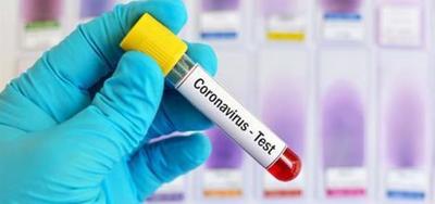 Un nuevo test rápido detecta COVID-19 en 15 minutos – Prensa 5