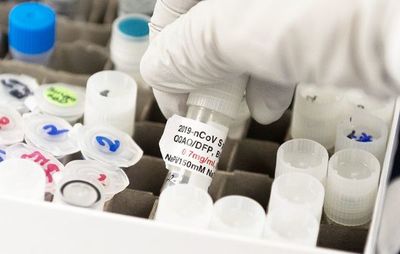 COVID-19: Sanofi Pasteur tiene dos vacunas en proceso - Nacionales - ABC Color