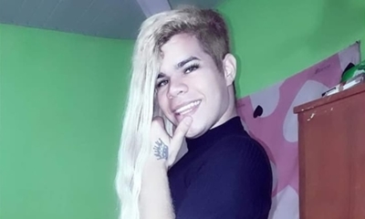 Pablito Pinto fue criticado y decidió pasar por el quirófano