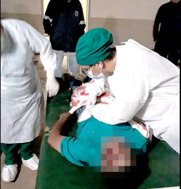 Motociclista muere tras ser chocado por otra moto, caer y ser arrollado por auto
