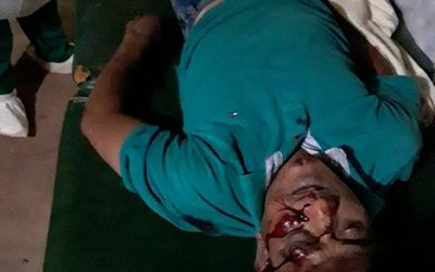 Motociclista muere tras ser arrollado por un automóvil – Diario TNPRESS