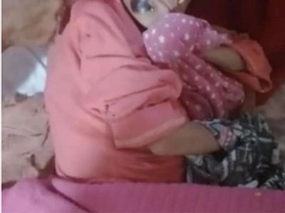Encontró a su hija con moretones y desnutrida