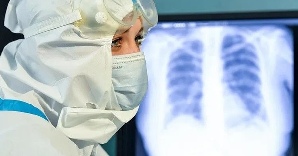 La Nación / Radiación pulmonar para tratar neumonía provocada por el COVID-19