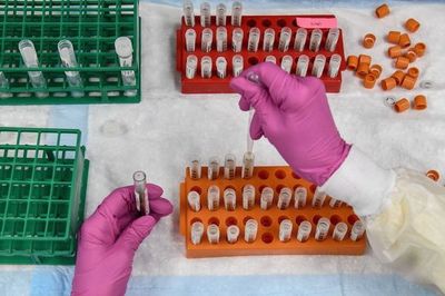 OMS calcula que vacunación contra el covid se daría a mediados de 2021 - Mundo - ABC Color