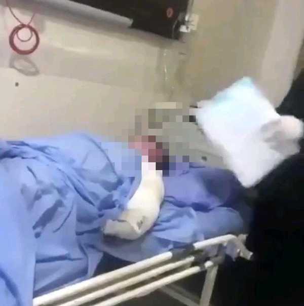 Quemó viva a su pareja