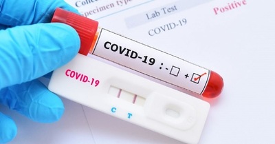 Un estudio español alerta a la Unión Europea de una "segunda ola" de Covid-19 » Ñanduti