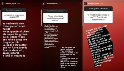 Marilina Bogado reveló a que cirugías estéticas se sometió - Teleshow