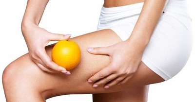 La Nación / Hábitos para combatir la celulitis y la retención de líquidos