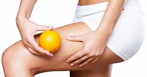 La Nación / Hábitos para combatir la celulitis y la retención de líquidos