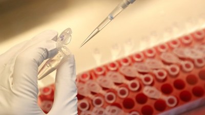 Aprueban para ensayos clínicos la vacuna china contra el coronavirus en forma de aerosol nasal - ADN Paraguayo