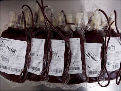 Exitoso tratamiento con plasma sanguíneo de paciente en Coronel Oviedo