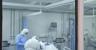 La Nación / Estudio revela que el coronavirus puede invadir el cerebro