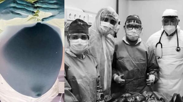 Realizan cirugías de alta complejidad con resultado exitoso en Hospital de Ayolas - Digital Misiones