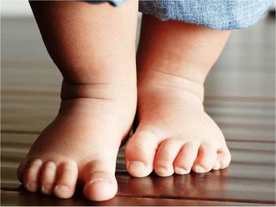 Muere niña de 1 año y 9 meses con rastros de maltrato