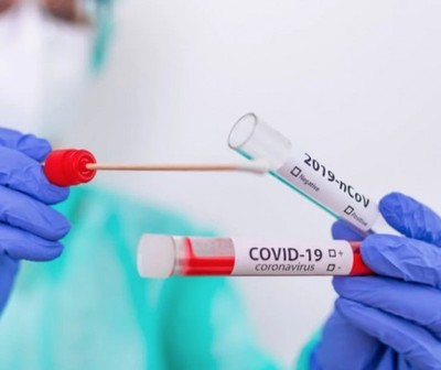 Viernes con 11 nuevos muertos a causa del COVID