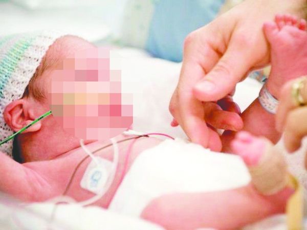 La muerte más joven por COVID la tuvo un prematuro