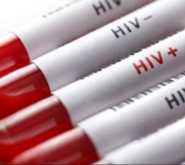Solicitan educación sexual para detener aumento de VIH en jóvenes - Paraguay.com