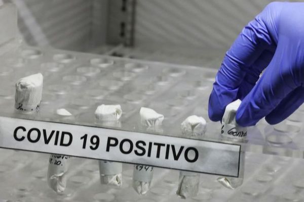 Salud reporta 11 fallecidos y 493 nuevos casos de Covid-19