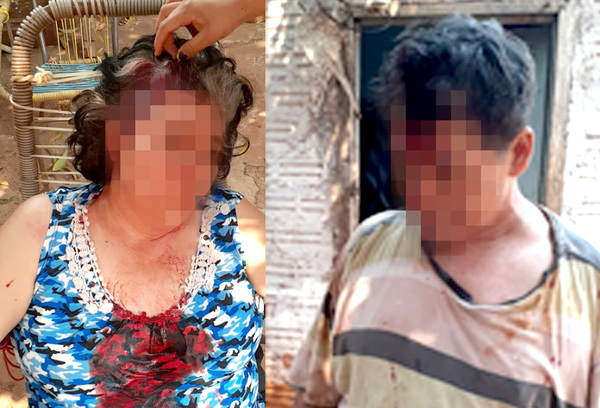 Pareja es apaleada por sus vecinos durante una riña en asentamiento de Pdte. Franco