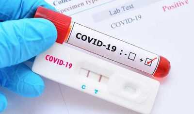 14 nuevos decesos por coronavirus | Noticias Paraguay