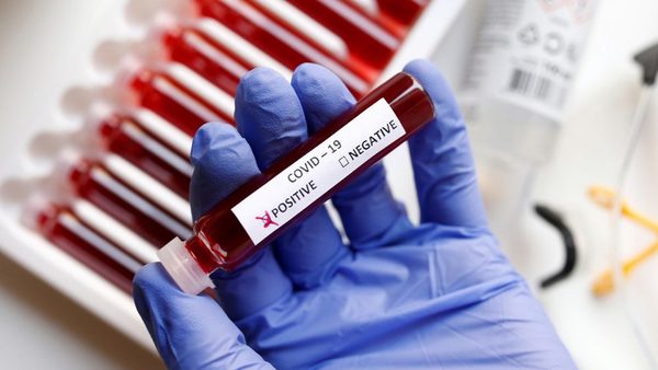PCR y test serológico: Las diferencias de cada prueba