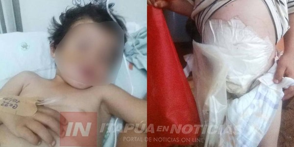 NECESITAN BOLSAS DE COLOSTOMÍA N° 2 PARA NIÑO DE 3 AÑOS.