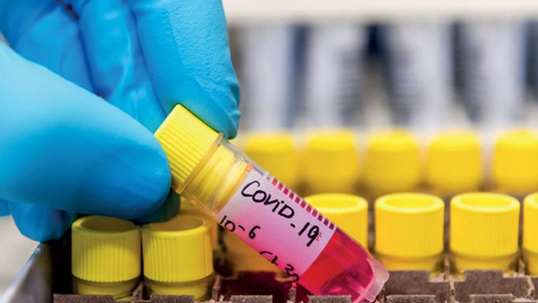 Covid: 28% de casos positivos está en el rango de 30 a 39 años de edad
