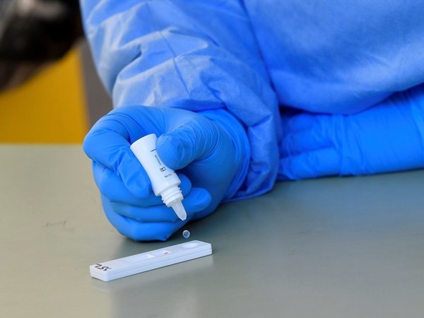 Francia apuesta por los tests de antígenos como alternativa y apoyo a los PCR