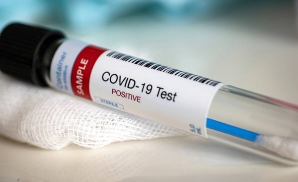 HOY / Suman 694 casos positivos y 18 nuevos fallecidos por COVID-19