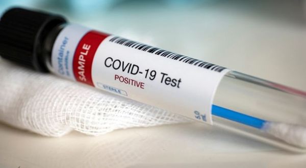 694 nuevos casos positivos y 18 decesos por COVID-19