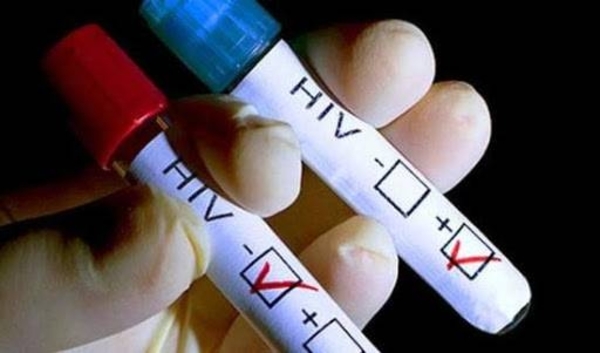 HOY / Lanzan campaña de prevención: “Ser joven no significa inmunidad contra el virus del VIH”