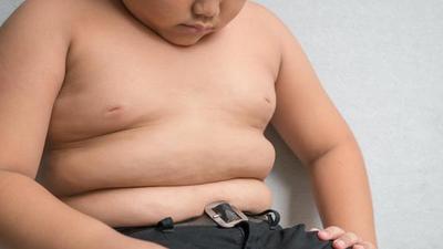 Cuando manda la comida chatarra: desnutrición crónica y exceso de peso y obesidad en niños menores de 5 años - ADN Paraguayo