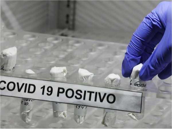 ¿Pertenecer al grupo sanguíneo A predispone a un Covid grave?