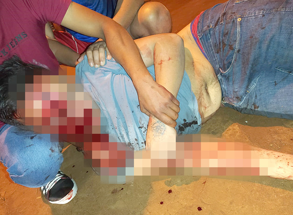 Automovilista se da a la fuga luego de atropellar y matar a motociclista