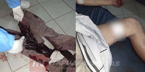CAZADOR RECIBIÓ UN DISPARO CON SU PROPIO RIFLE EN ALTO VERÁ.