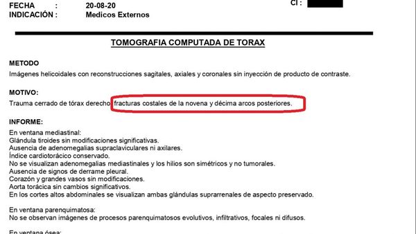 Víctima denuncia agresión de policía y termina imputado