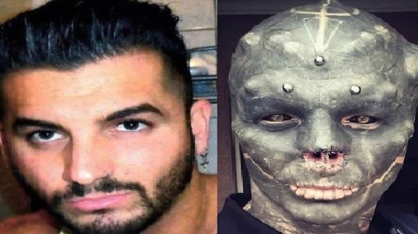 Crónica / Arriero se hizo cirugía para ser extraterrestre