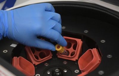 Los estragos del coronavirus comparados con otros virus mortales - Ciencia - ABC Color