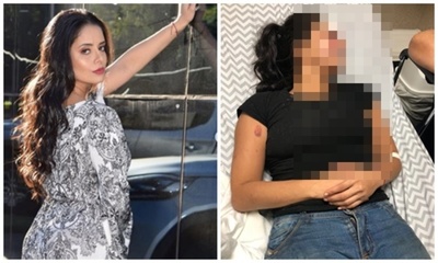Jessi Franco sufrió un accidente que la llevó al quirófano