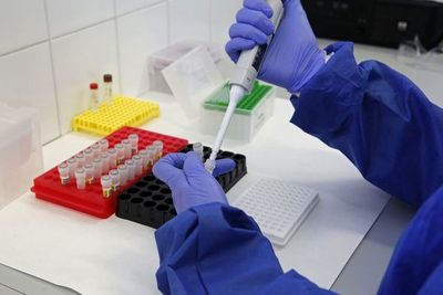 La OMS advierte que dos millones de personas podrían morir por covid-19 en el mundo - Mundo - ABC Color
