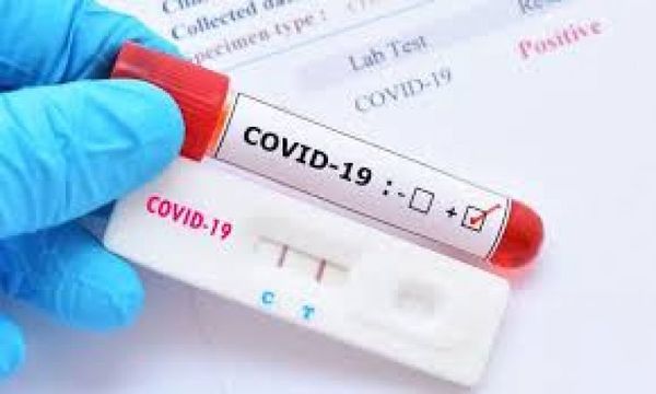 Confirman 822 casos positivos y 18 nuevos fallecidos por COVID-19