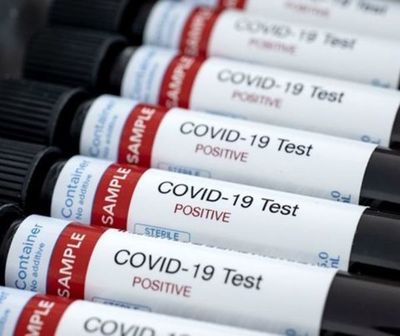 COVID: 18 muertos y 822 nuevos positivos este viernes