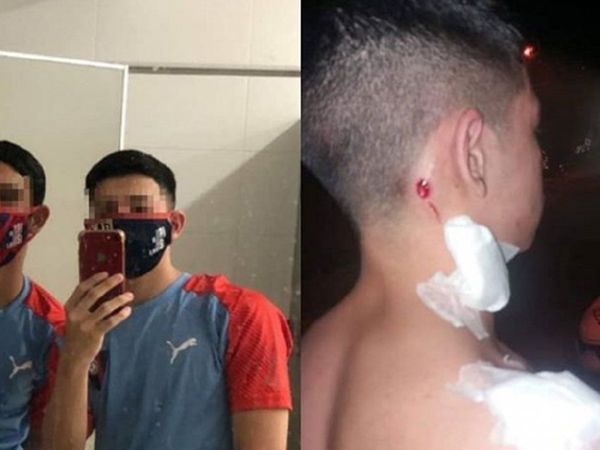 Denuncian brutal agresión policial a adolescentes tras partido de Cerro