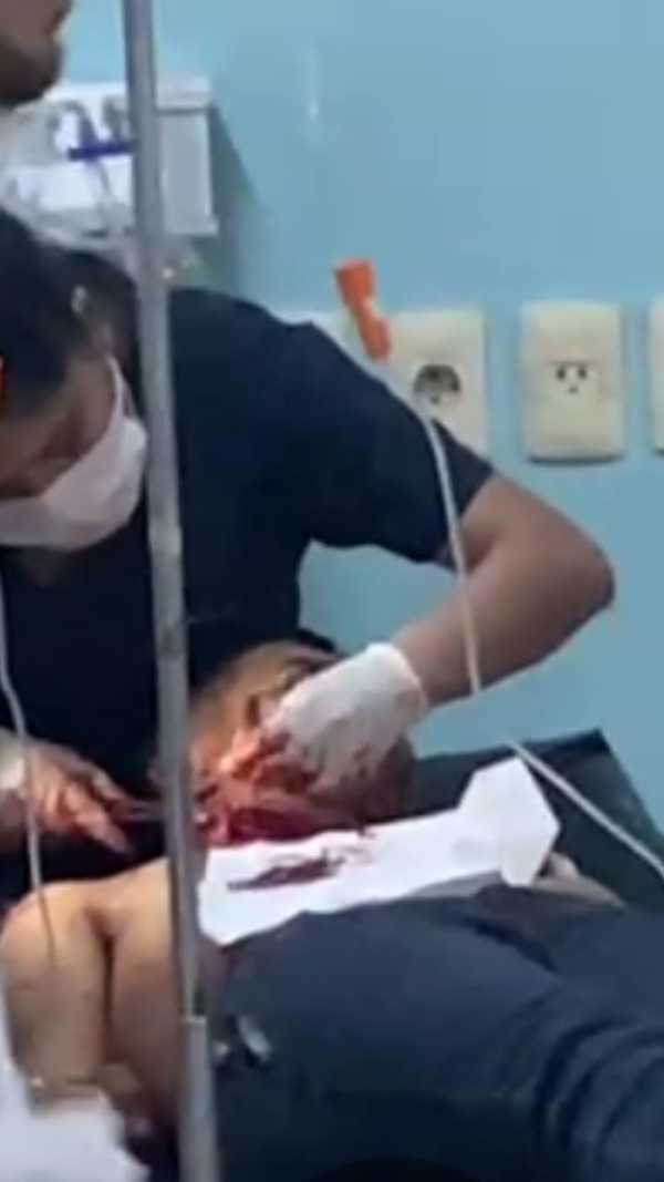 Mujer ATACA un HOMBRE con un pedazo de VIDRIO