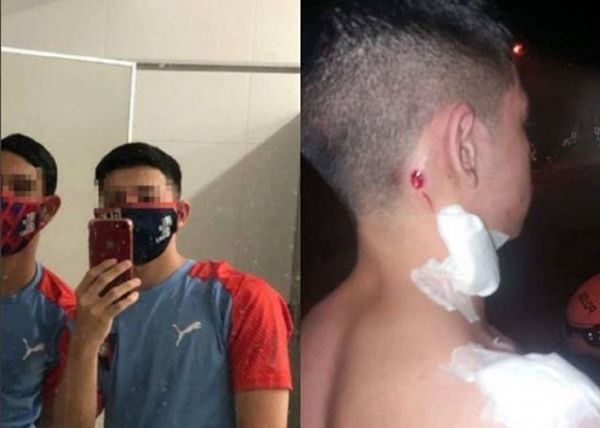 Denuncian brutal agresión policial a adolescentes tras partido de Cerro Porteño
